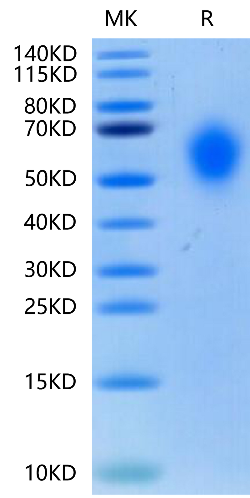 Biotinylated Cynomolgus CD300A on Tris-Bis PAGE under reduced condition. The purity is greater than 95%.Biotinylated Cynomolgus CD300A Protein