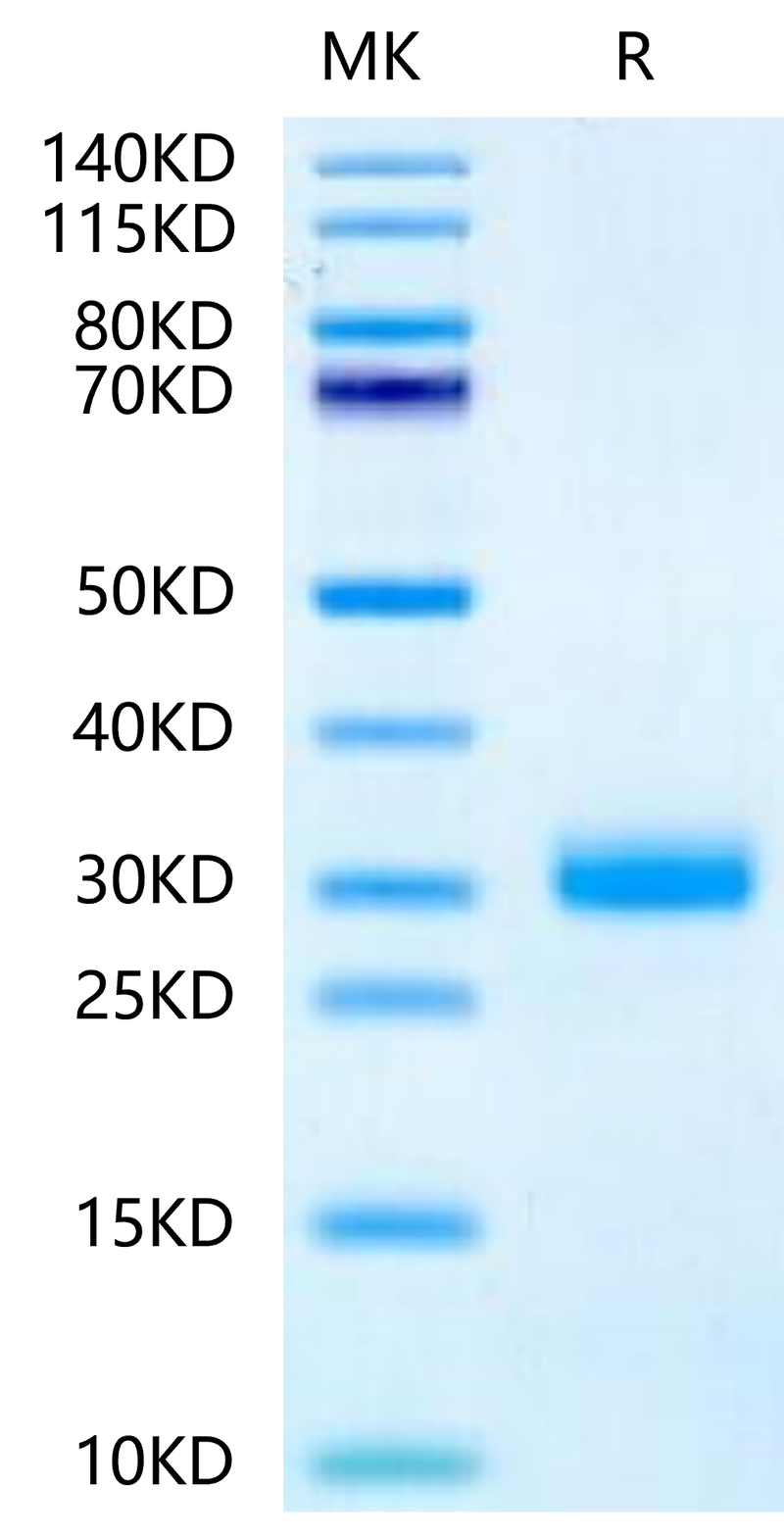 Mouse Noggin on Tris-Bis PAGE under reduced condition. The purity is greater than 95%.Recombinant Mouse Noggin Protein