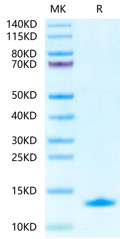 Human S100A14-on Tris-Bis PAGE under reduced condition. The purity is greater than 95%.Recombinant Human S100A14-Protein
