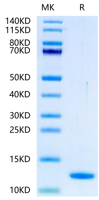Human BLOC1S2 on Tris-Bis PAGE under reduced condition. The purity is greater than 95%.Recombinant Human BLOC1S2-Protein