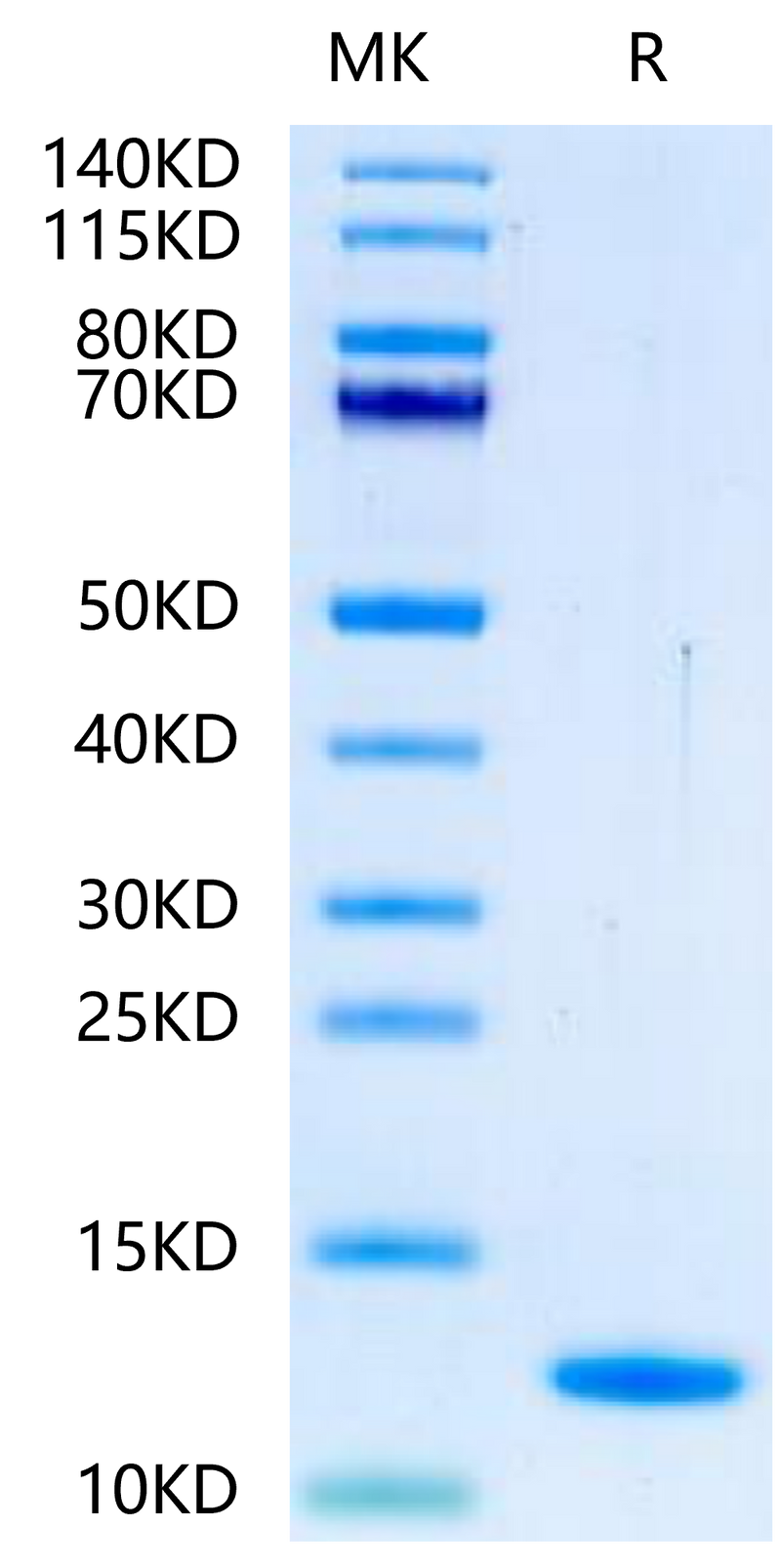 Human BLOC1S2 on Tris-Bis PAGE under reduced condition. The purity is greater than 95%.Recombinant Human BLOC1S2-Protein