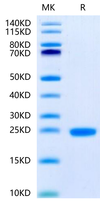 Human IL-1F10 on Tris-Bis PAGE under reduced condition. The purity is greater than 95%.Recombinant Human IL-1F10/IL-38-Protein