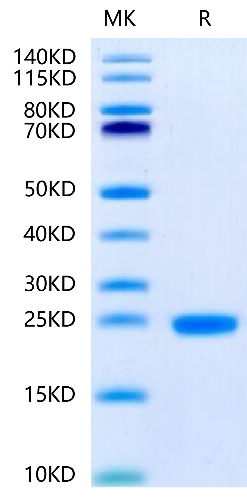 Human IL-1F10 on Tris-Bis PAGE under reduced condition. The purity is greater than 95%.Recombinant Human IL-1F10/IL-38-Protein