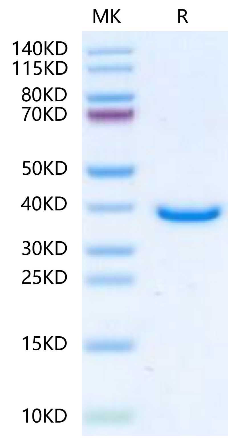 Human TPM1 on Tris-Bis PAGE under reduced condition. The purity is greater than 95%.Recombinant Human TPM1-Protein
