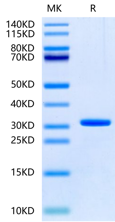 Human UBASH3B on Tris-Bis PAGE under reduced condition. The purity is greater than 95%.Recombinant Human UBASH3B/STS1-Protein