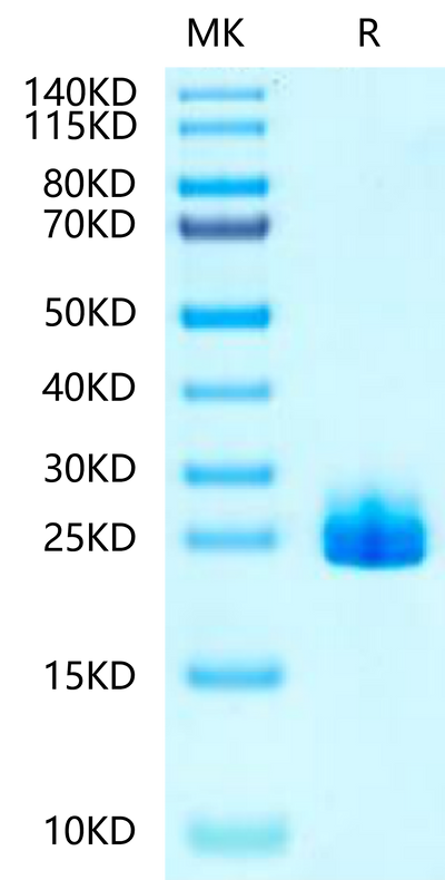 Hamster FGF21 on Tris-Bis PAGE under reduced condition. The purity is greater than 95%.Recombinant Hamster FGF21-Protein, Active
