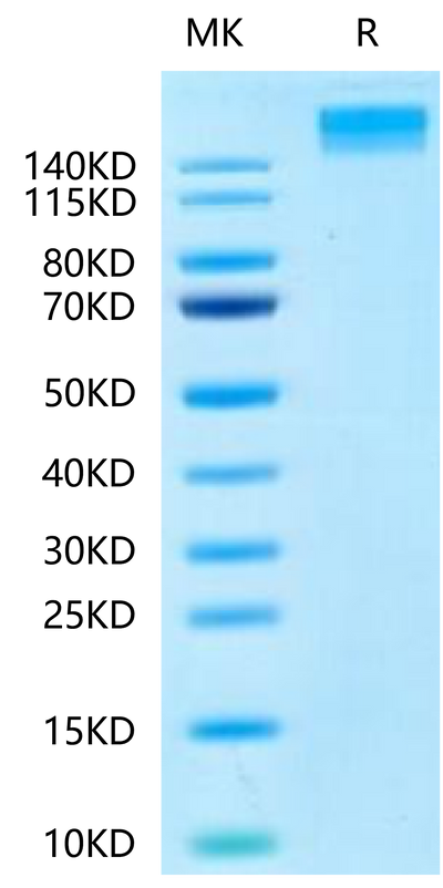 Human SEZ6 on Tris-Bis PAGE under reduced condition. The purity is greater than 95%.Recombinant Human SEZ6 Protein, Active