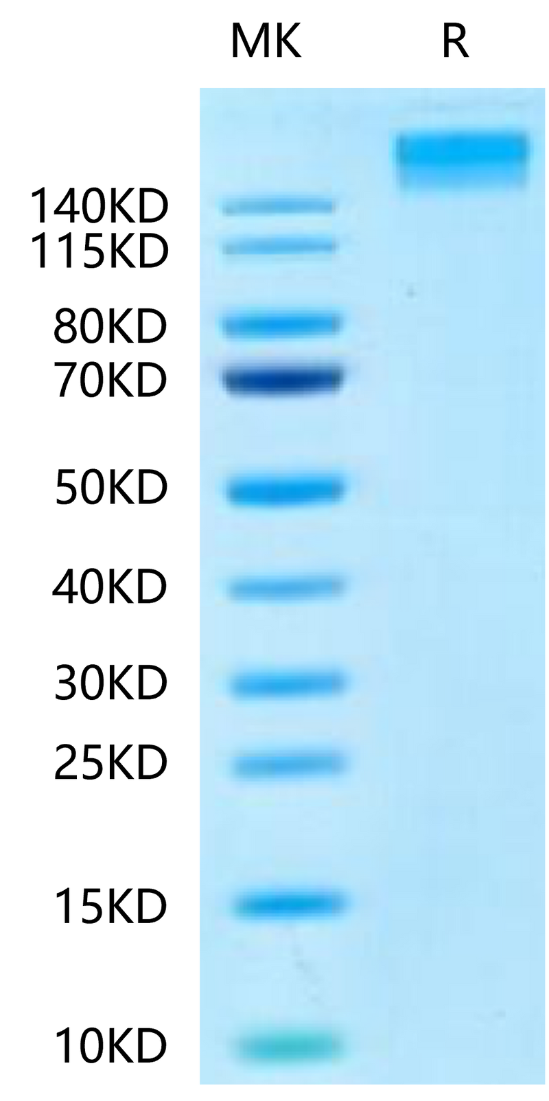 Human SEZ6 on Tris-Bis PAGE under reduced condition. The purity is greater than 95%.Recombinant Human SEZ6 Protein, Active