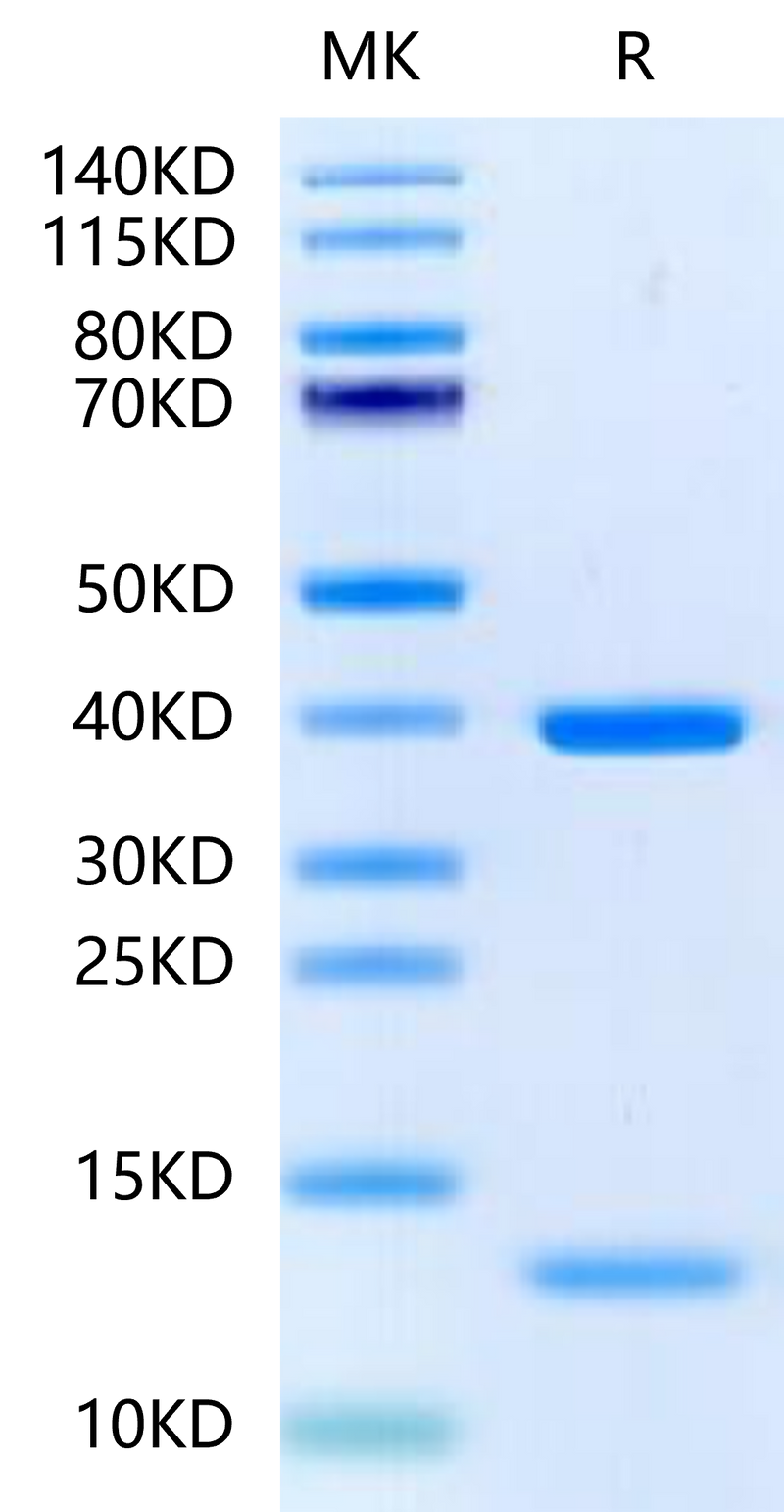 HLA-A*11:01&B2M&KRAS G12D (VVGADGVGK) Monomer on Tris-Bis PAGE under reduced condition. The purity is greater than 95%.Recombinant Human HLA-A*11:01&B2M&KRAS G12D (VVGADGVGK) Monomer Protein