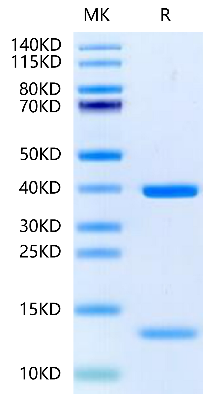 Biotinylated HLA-A*11:01&B2M&KRAS G12D (VVGADGVGK) Monomer on Tris-Bis PAGE under reduced condition. The purity is greater than 95%.Biotinylated Human HLA-A*11:01&B2M&KRAS G12D (VVGADGVGK) Monomer Protein