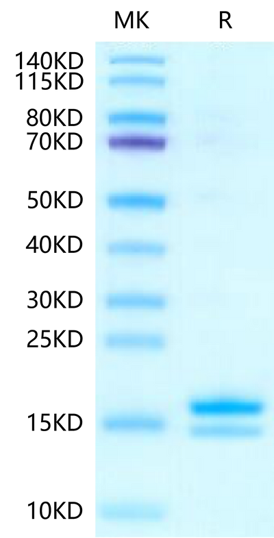 Human IL-2 on Tris-Bis PAGE under reduced condition. The purity is greater than 95%.Recombinant Human IL-2 Protein, Active