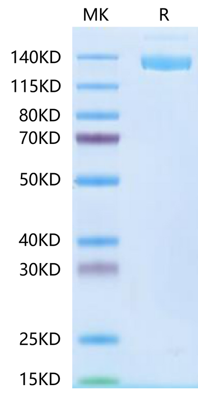 SARS-COV-2 Spike S Trimer on Tris-Bis PAGE under reduced condition. The purity is greater than 95%.Recombinant SARS-COV-2 Spike S Trimer Protein, Active