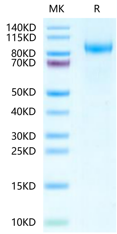 Mouse VCAM-1 on Tris-Bis PAGE under reduced condition. The purity is greater than 95%.Recombinant Mouse VCAM-1/CD106 Protein