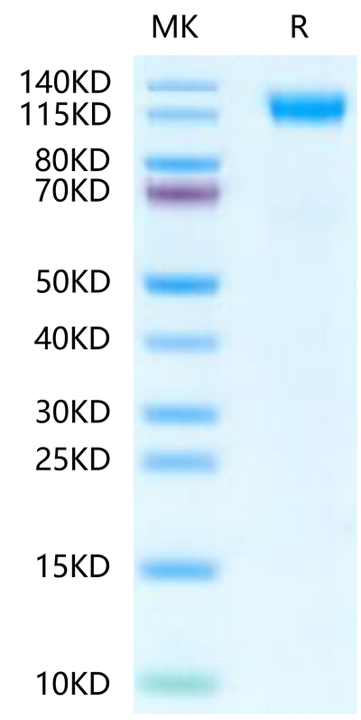 Mouse CD45 on Tris-Bis PAGE under reduced condition. The purity is greater than 95%.Recombinant Mouse CD45/PTPRC Protein