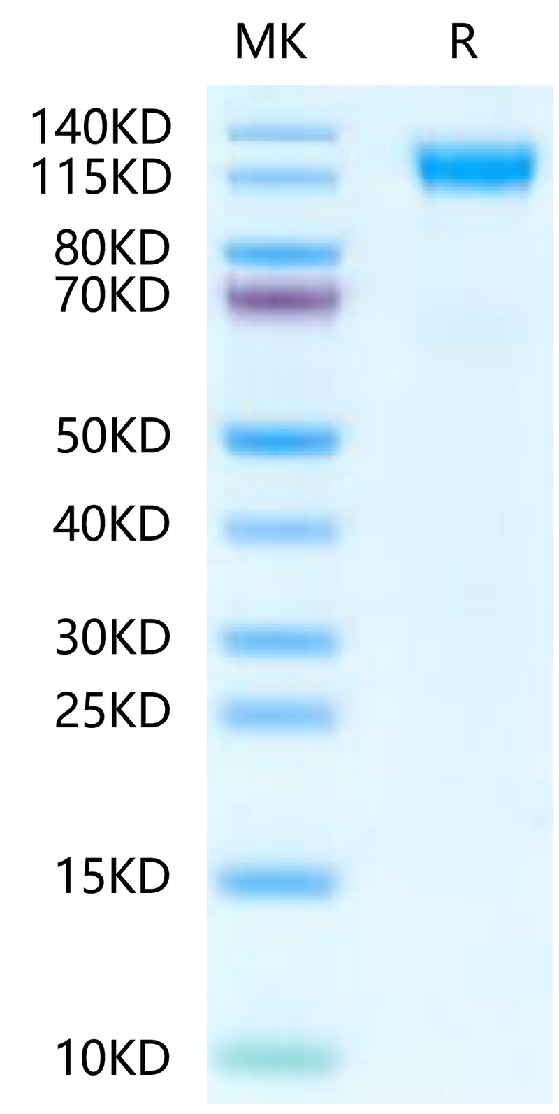Mouse CD45 on Tris-Bis PAGE under reduced condition. The purity is greater than 95%.Recombinant Mouse CD45/PTPRC Protein