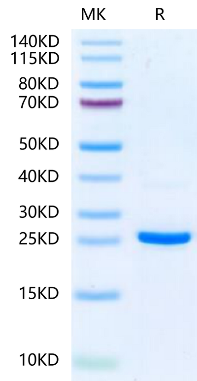 Human NRAS on Tris-Bis PAGE under reduced condition. The purity is greater than 95%.Recombinant Human NRAS-Protein