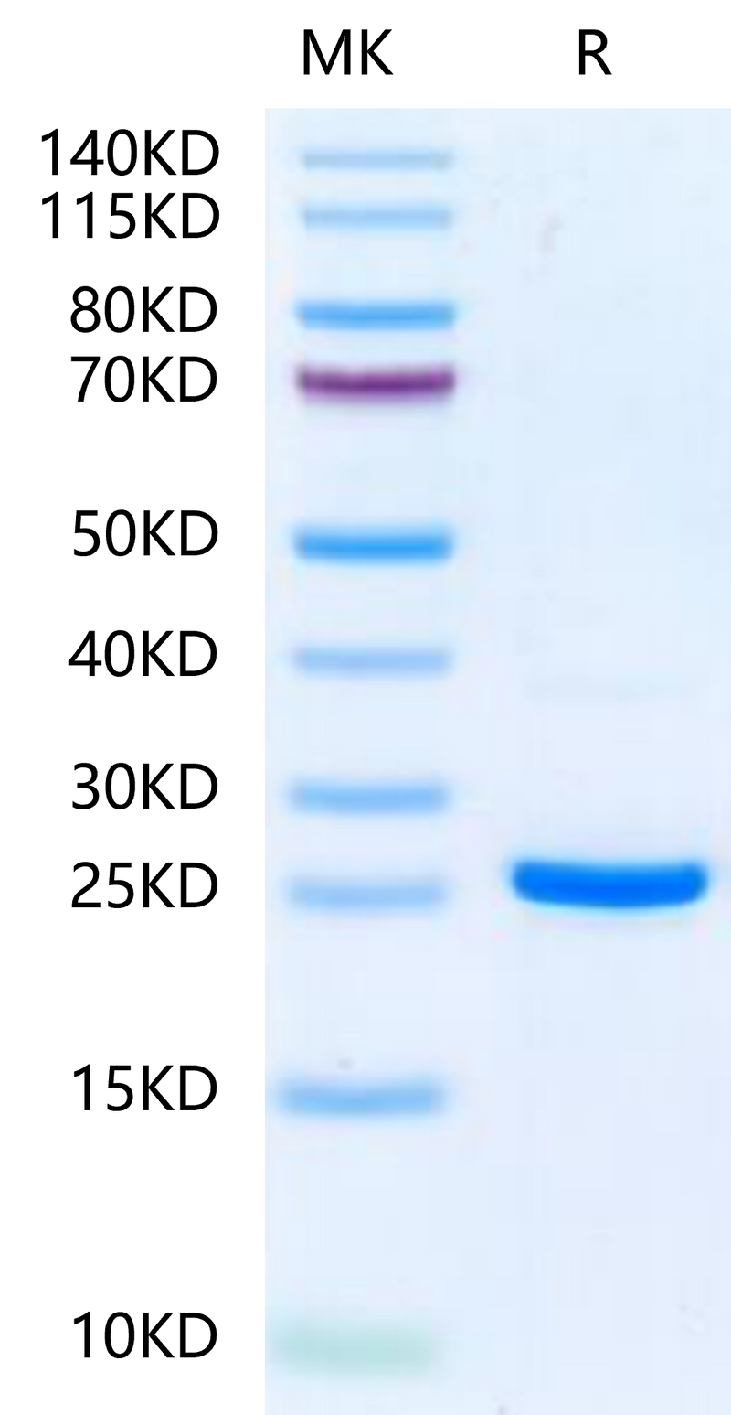 Human NRAS on Tris-Bis PAGE under reduced condition. The purity is greater than 95%.Recombinant Human NRAS-Protein
