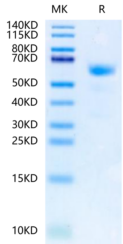 Human NKp80 on Tris-Bis PAGE under reduced condition. The purity is greater than 95%.Recombinant Human NKp80/CLEC5C-Protein