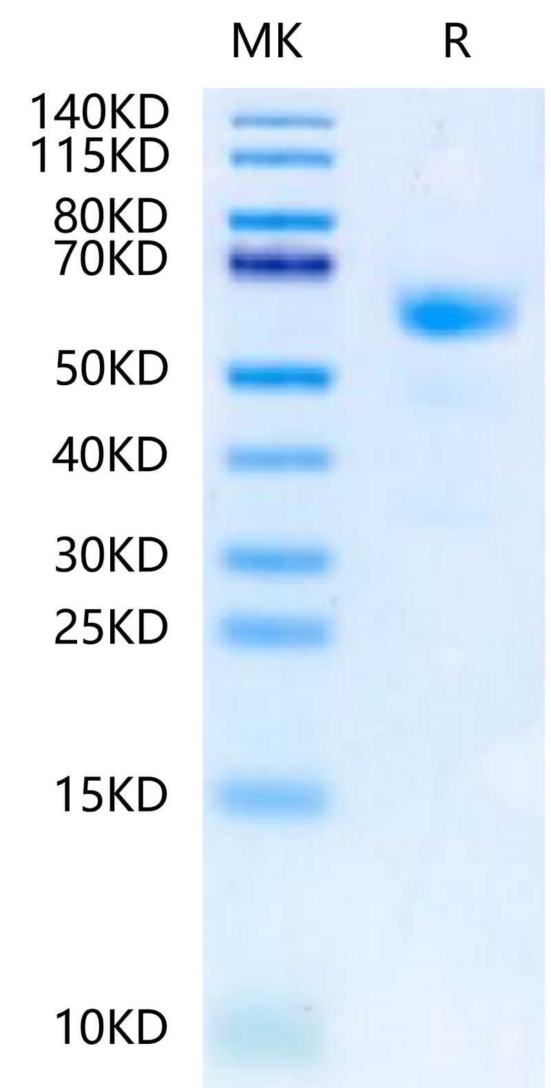 Human NKp80 on Tris-Bis PAGE under reduced condition. The purity is greater than 95%.Recombinant Human NKp80/CLEC5C-Protein