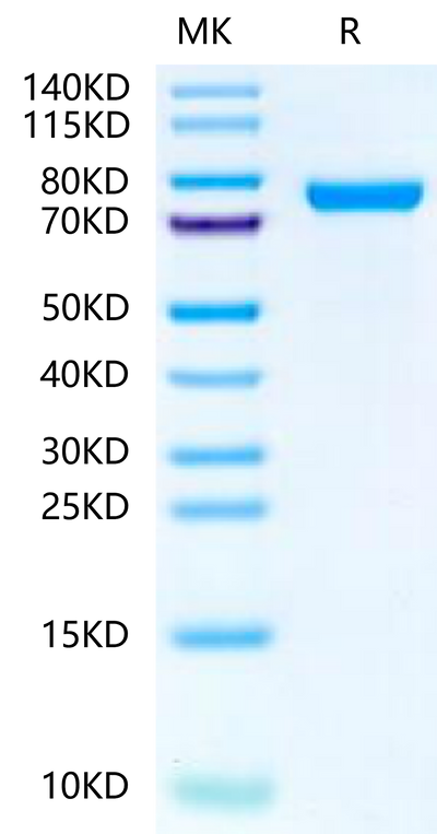 Rat IL-13Ra2 on Tris-Bis PAGE under reduced condition. The purity is greater than 95%.Recombinant Rat IL-13Ra2 Protein, Active