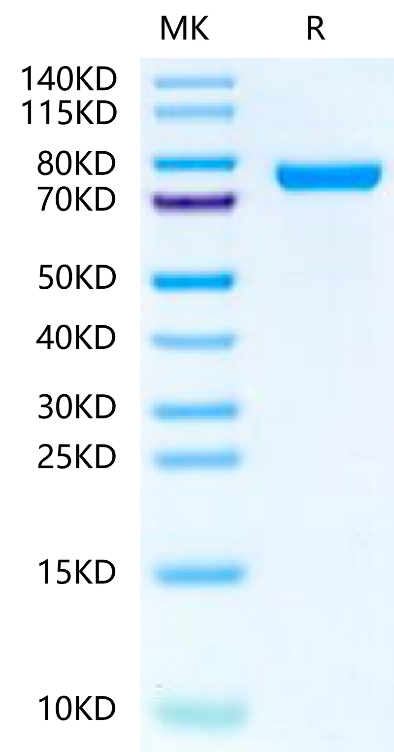 Rat IL-13Ra2 on Tris-Bis PAGE under reduced condition. The purity is greater than 95%.Recombinant Rat IL-13Ra2 Protein, Active