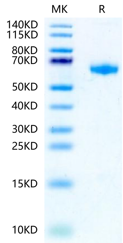 Rat IL-22R alpha 1 on Tris-Bis PAGE under reduced condition. The purity is greater than 95%.Recombinant Rat IL-22R alpha 1 Protein, Active