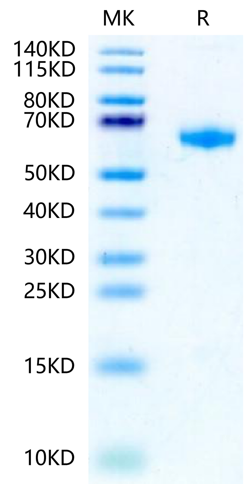 Rat IL-22R alpha 1 on Tris-Bis PAGE under reduced condition. The purity is greater than 95%.Recombinant Rat IL-22R alpha 1 Protein, Active