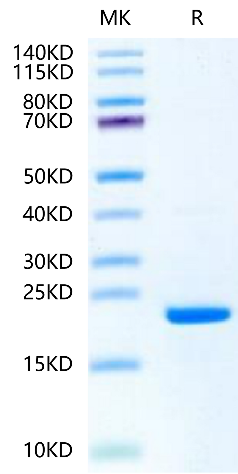 Ferret TNF alpha on Tris-Bis PAGE under reduced condition. The purity is greater than 95%.Recombinant Ferret TNF alpha-Protein, Active