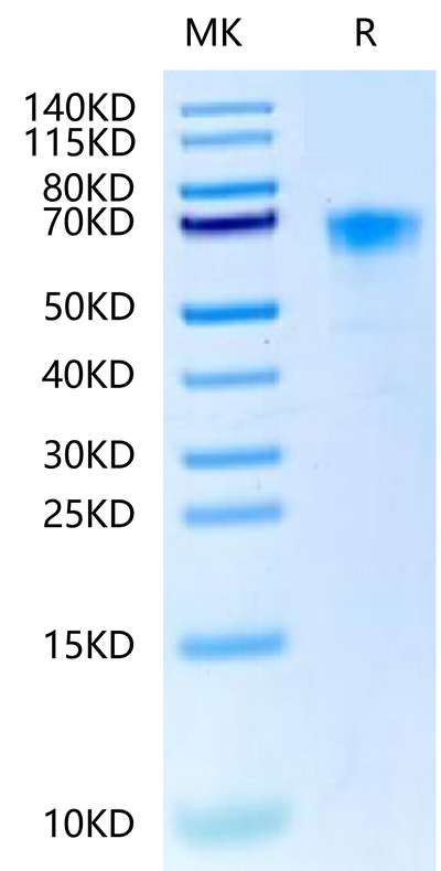 Cynomolgus/Rhesus macaque DKK1 on Tris-Bis PAGE under reduced condition. The purity is greater than 95%.Recombinant Cynomolgus/Rhesus macaque DKK1-Protein, Active
