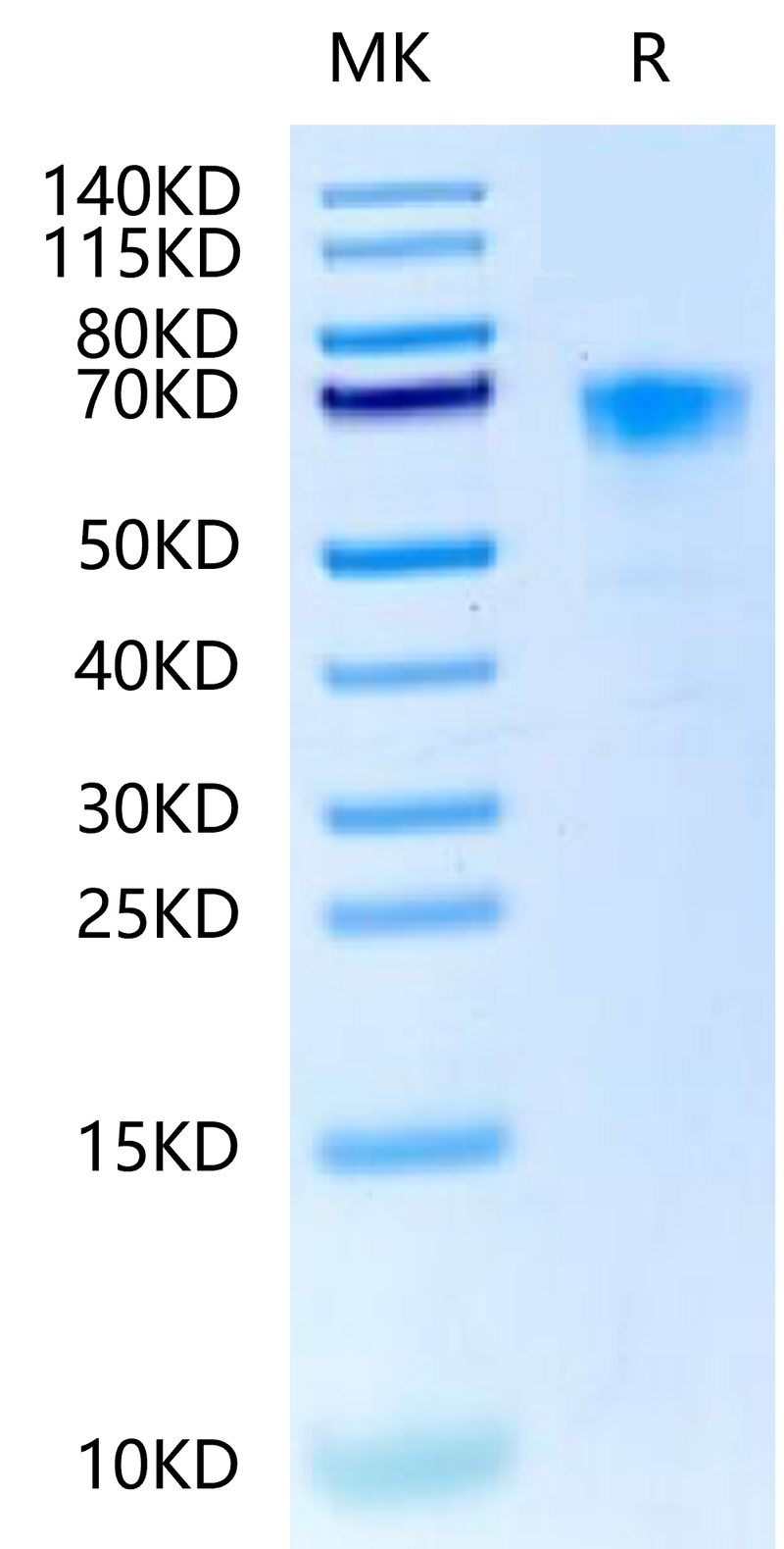 Cynomolgus/Rhesus macaque DKK1 on Tris-Bis PAGE under reduced condition. The purity is greater than 95%.Recombinant Cynomolgus/Rhesus macaque DKK1-Protein, Active
