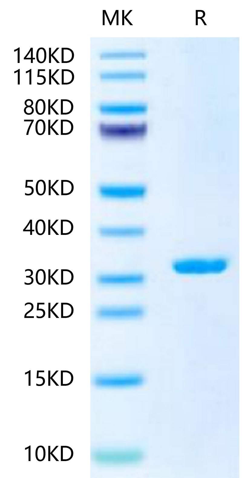 SARS-CoV-2 3CLpro (L50F, E166A, L167F) on Tris-Bis PAGE under reduced condition. The purity is greater than 95%.Recombinant SARS-CoV-2 3CLpro/3C-like Protease Protein (L50F, E166A, L167F)