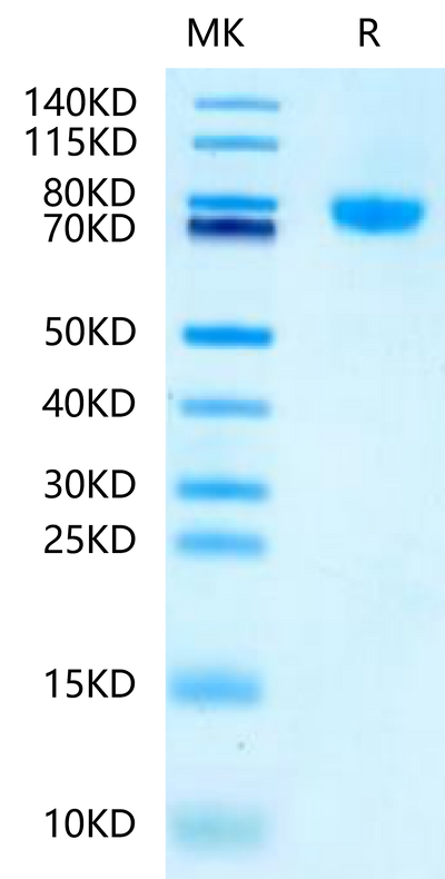 Mouse LRRC15 on Tris-Bis PAGE under reduced condition. The purity is greater than 95%.Recombinant Mouse LRRC15/LIB Protein, Active