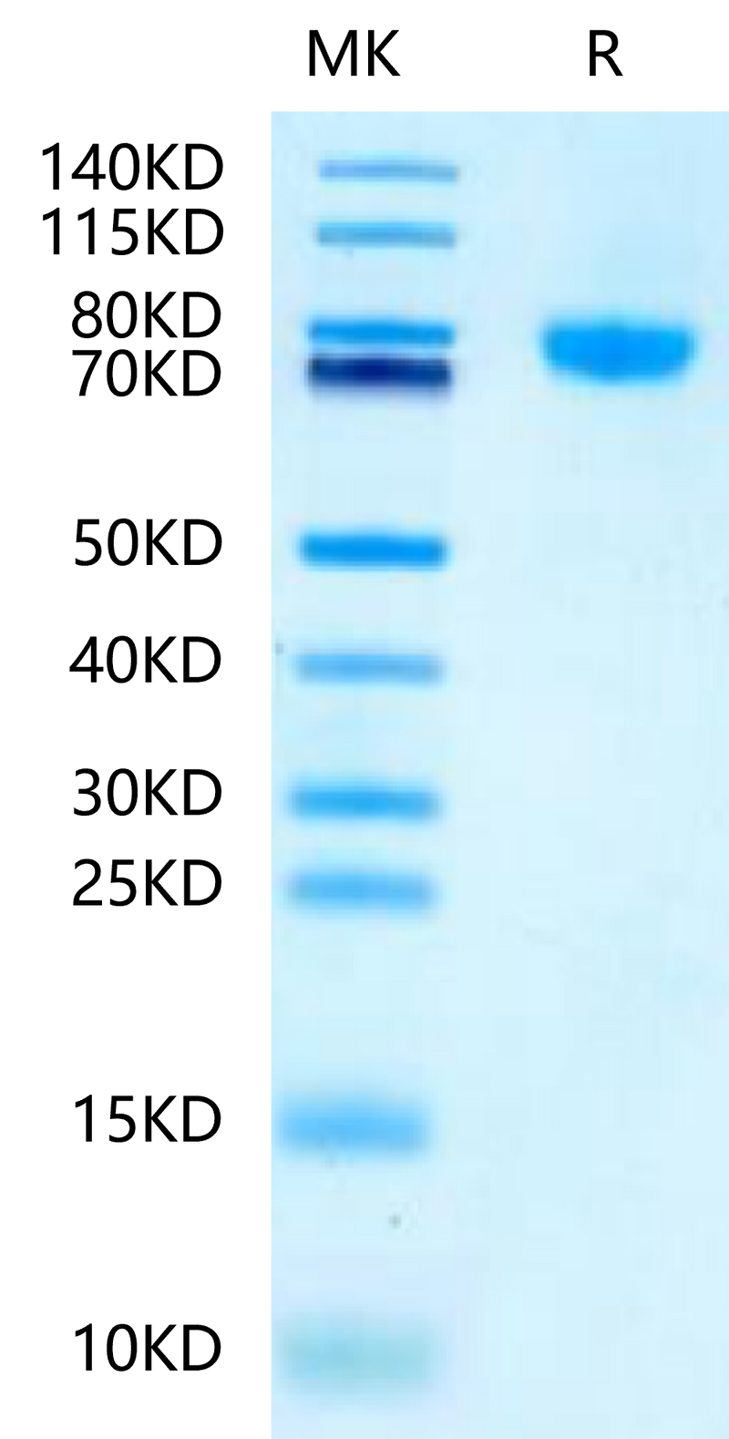 Mouse LRRC15 on Tris-Bis PAGE under reduced condition. The purity is greater than 95%.Recombinant Mouse LRRC15/LIB Protein, Active