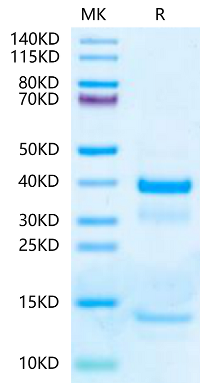 Mouse tPA on Tris-Bis PAGE under reduced condition. The purity is greater than 95%.Recombinant Mouse tPA-Protein