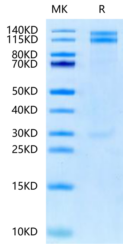Human ITGA8&ITGB1 on Tris-Bis PAGE under reduced condition. The purity is greater than 95%.Recombinant Human Integrin alpha 8 beta 1 (ITGA8&ITGB1) -Heterodimer Protein