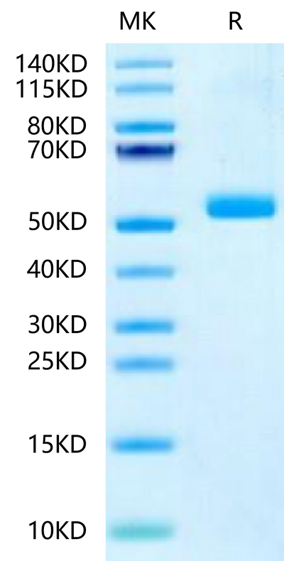 Human IL-23 P19 on Tris-Bis PAGE under reduced condition. The purity is greater than 95%.Recombinant Human IL-23 P19/IL-23A-Protein