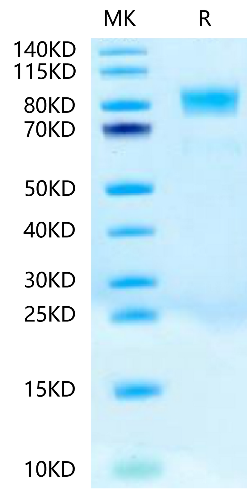 Biotinylated Human CD117 on Tris-Bis PAGE under reduced condition. The purity is greater than 95%.Biotinylated Human CD117 Protein, Active