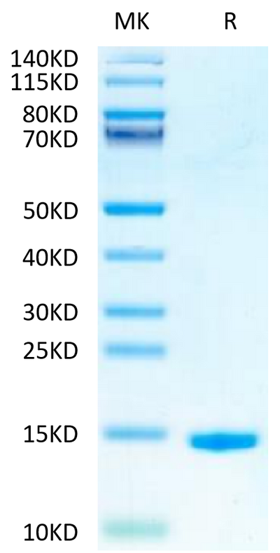 Mouse GM-CSF on Tris-Bis PAGE under reduced condition. The purity is greater than 95%.Recombinant Mouse GM-CSF Protein, Active