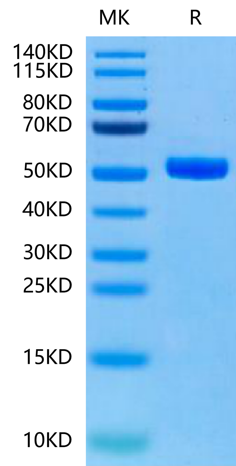 Human Peptide Ready HLA-A*11:01&B2M Monomer-on Tris-Bis PAGE under reduced condition. The purity is greater than 95%.Recombinant Human Peptide Ready HLA-A*11:01&B2M Monomer-Protein, Active