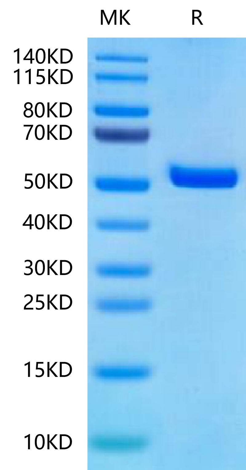 Biotinylated Human Peptide Ready HLA-A*11:01&B2M Monomer on Tris-Bis PAGE under reduced condition. The purity is greater than 95%.Biotinylated Human Peptide Ready HLA-A*11:01&B2M Monomer-Protein, Active