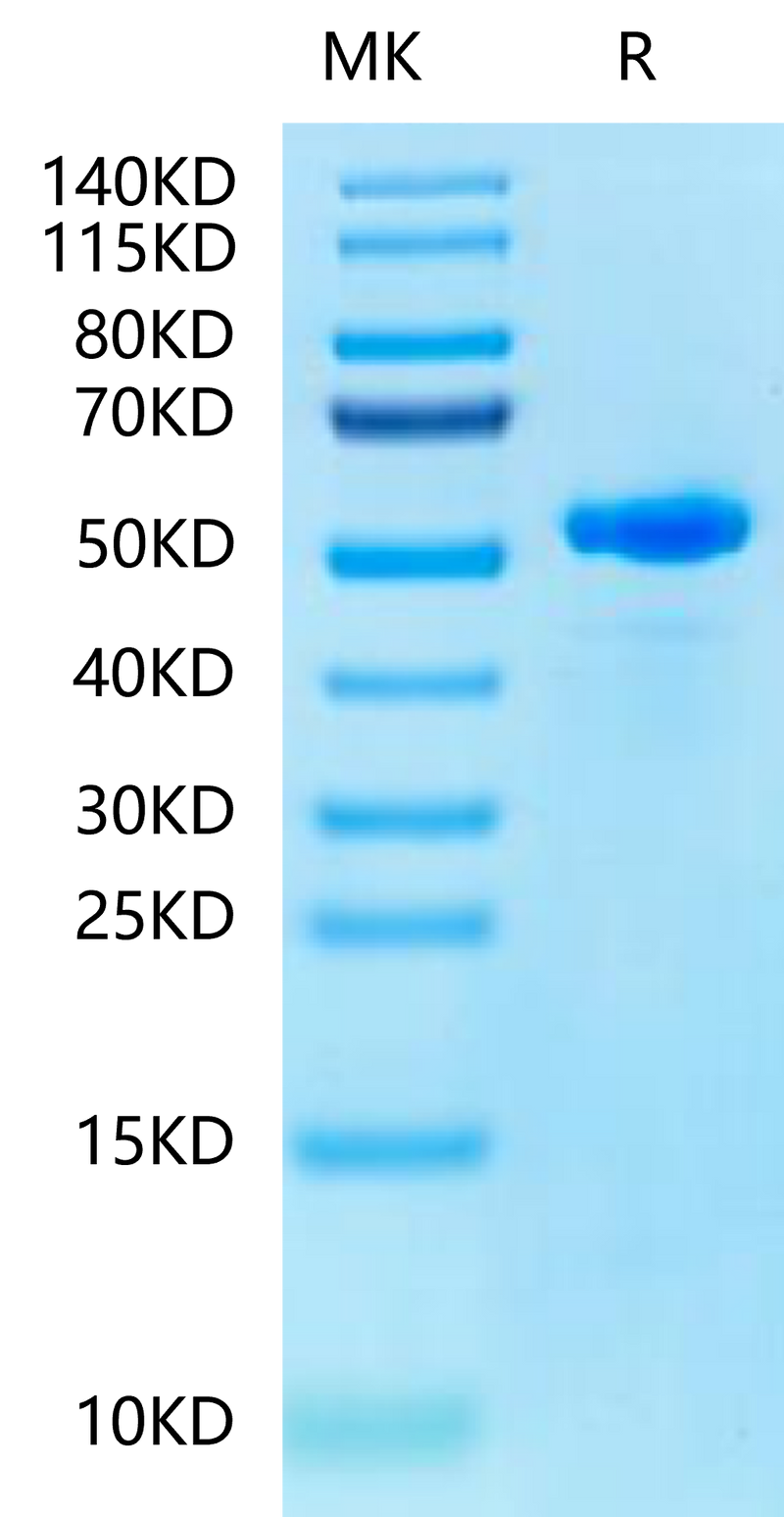 Human Peptide Ready HLA-E*01:03&B2M Monomer on Tris-Bis PAGE under reduced condition. The purity is greater than 95%.Recombinant Human Peptide Ready HLA-E*01:03&B2M Monomer-Protein