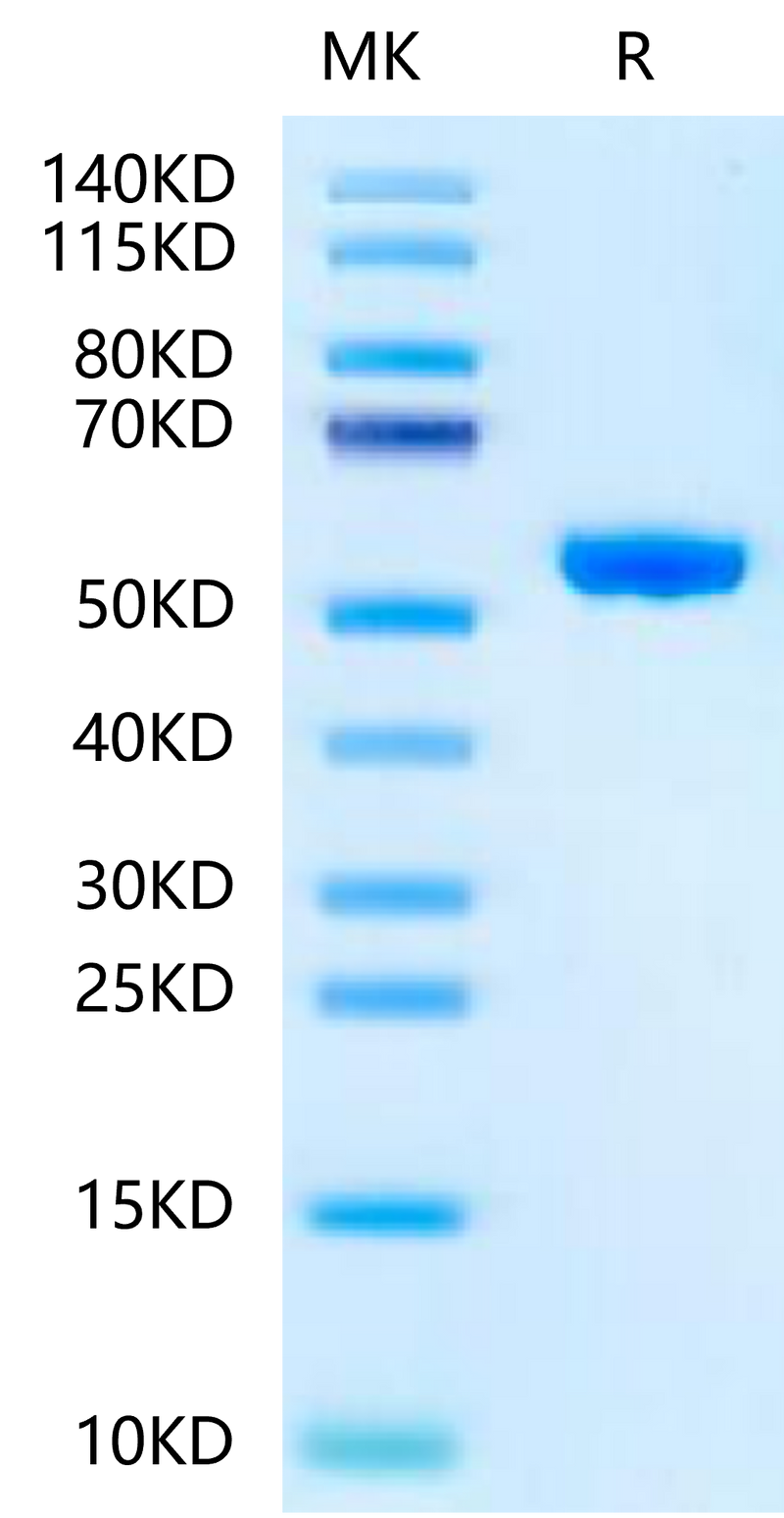 Human Peptide Ready HLA-A*02:01&B2M Monomer on Tris-Bis PAGE under reduced condition. The purity is greater than 95%.Recombinant Human Peptide Ready HLA-A*02:01&B2M Monomer-Protein, Active