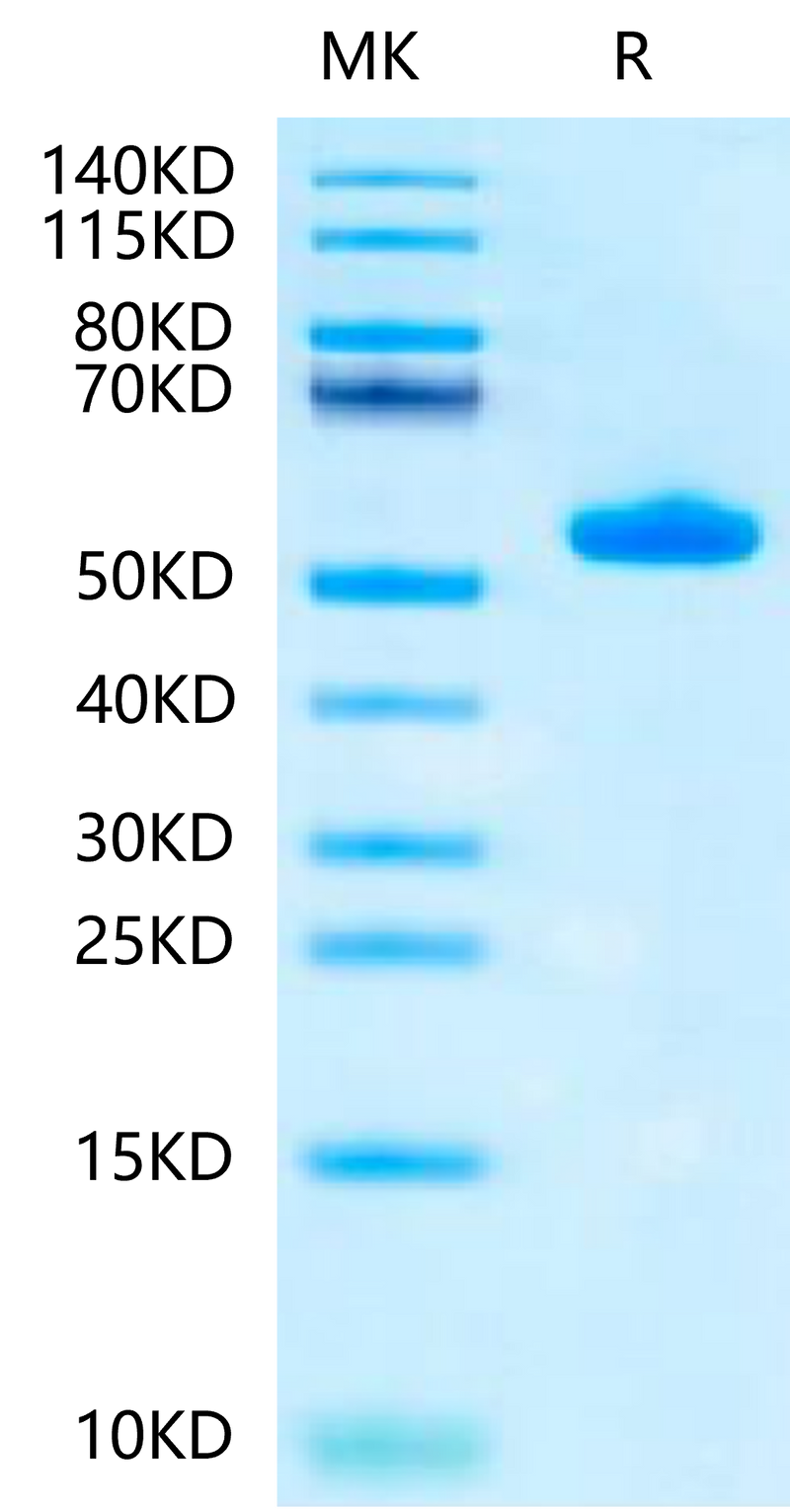Biotinylated Human Peptide Ready HLA-A*02:01&B2M Monomer on Tris-Bis PAGE under reduced condition. The purity is greater than 95%.Biotinylated Human Peptide Ready HLA-A*02:01&B2M Monomer-Protein, Active