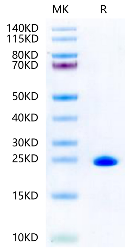 Mouse BID on Tris-Bis PAGE under reduced condition. The purity is greater than 95%.Recombinant Mouse BID Protein, Active