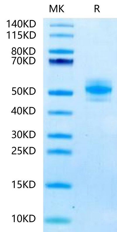 Mouse GM-CSF on Tris-Bis PAGE under reduced condition. The purity is greater than 95%.Recombinant Mouse GM-CSF Protein, Active