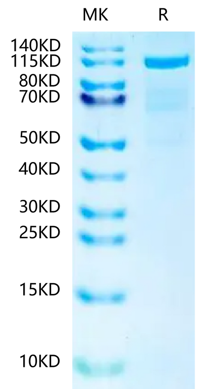 Human N Cadherin on Tris-Bis PAGE under reduced condition. The purity is greater than 90%.Recombinant Human N Cadherin-Protein