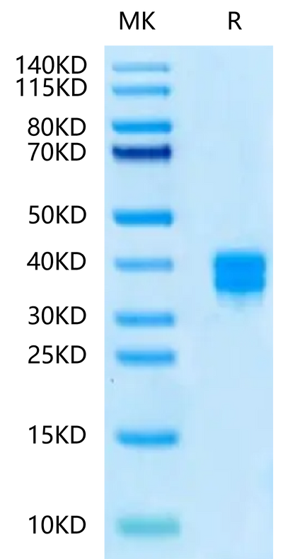 Human CD8 alpha&beta Heterodimer on Tris-Bis PAGE under reduced condition. The purity is greater than 95%.Recombinant Human CD8 alphaβ Heterodimer Protein, Active