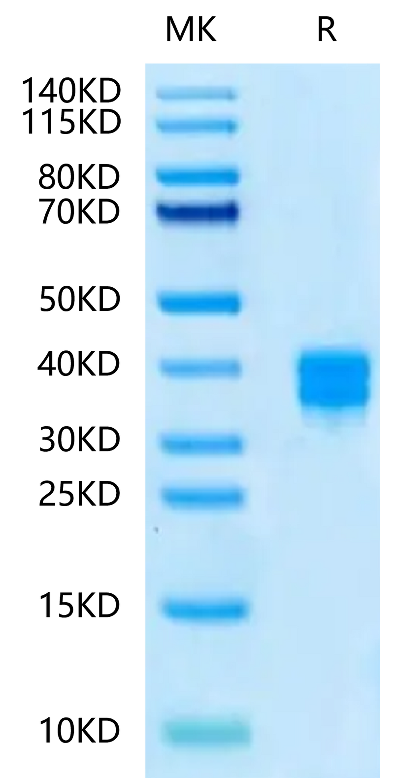 Human CD8 alpha&beta Heterodimer on Tris-Bis PAGE under reduced condition. The purity is greater than 95%.Recombinant Human CD8 alphaβ Heterodimer Protein, Active