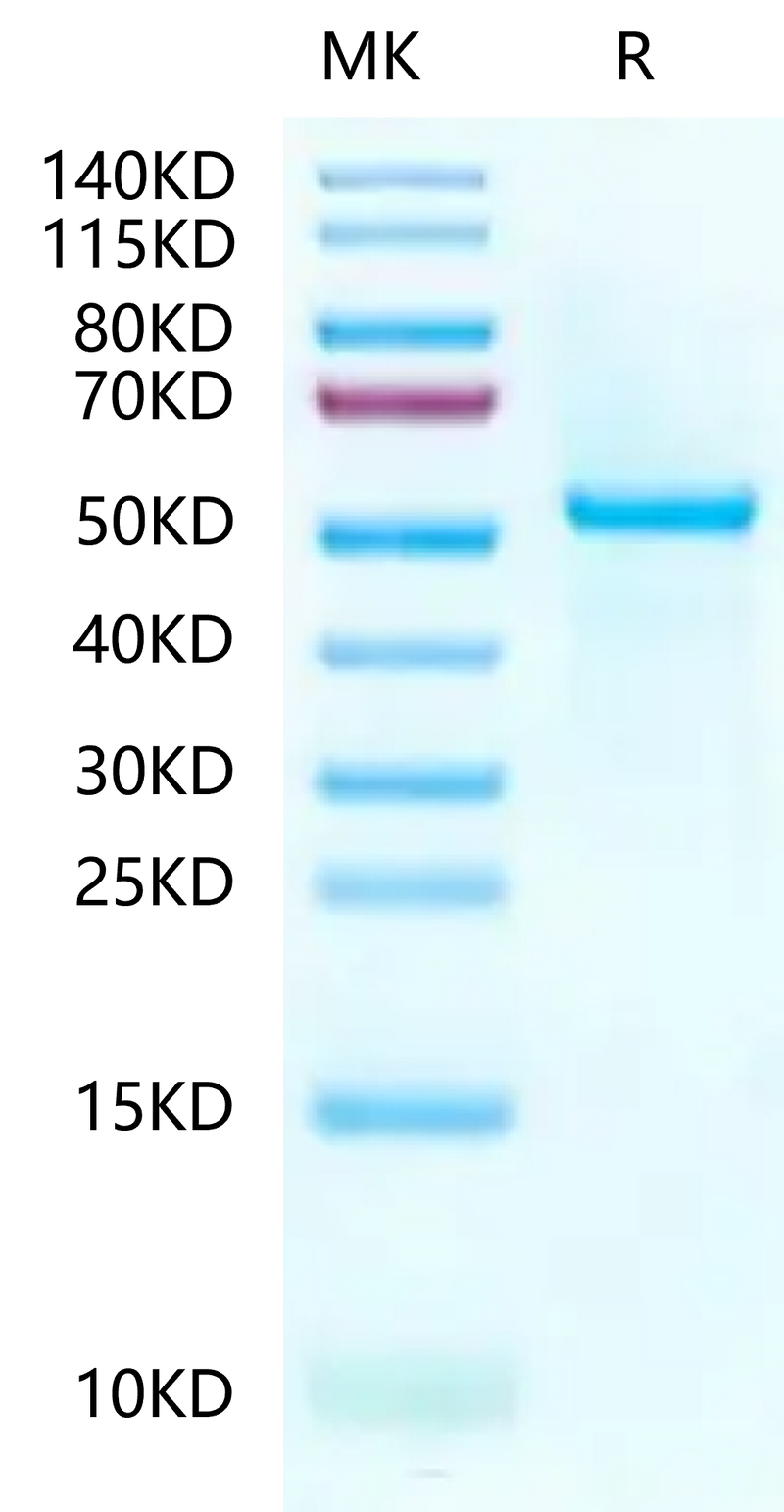 Human Peptide Ready HLA-A*03:01&B2M Monomer on Tris-Bis PAGE under reduced condition. The purity is greater than 95%.Recombinant Human Peptide Ready HLA-A*03:01&B2M Monomer-Protein, Active