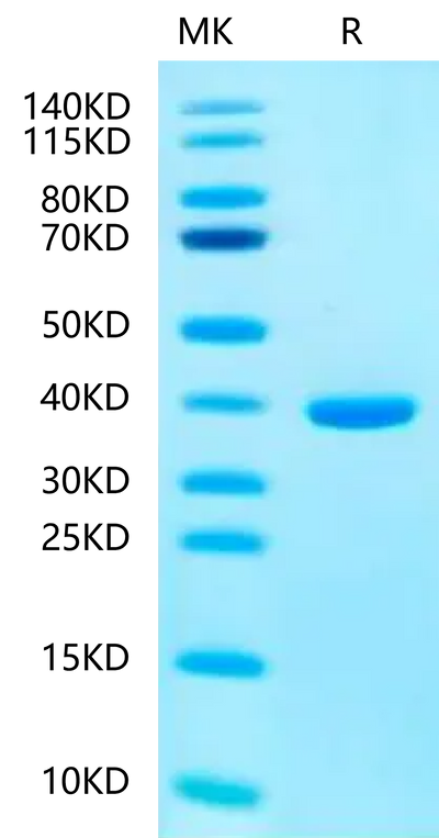 Human SMR3B on Tris-Bis PAGE under reduced condition. The purity is greater than 95%.Recombinant Human SMR3B-Protein